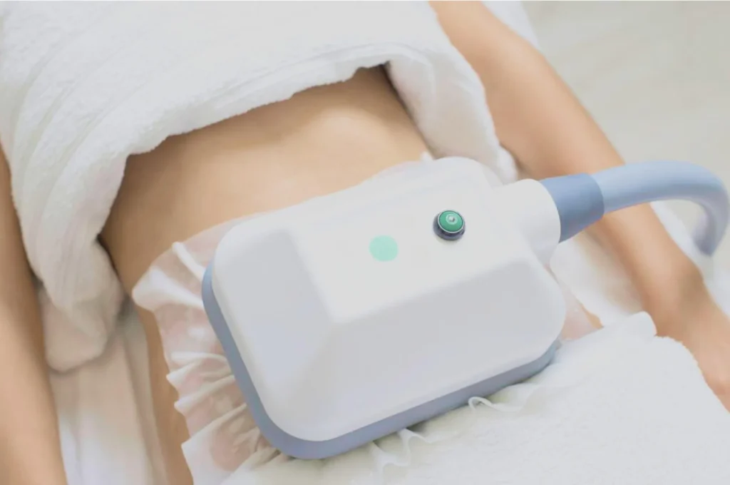 How Fat Freezing and HIFU Work Together? 3 advantages to combining Fat Freezing and HIFU Smethwick