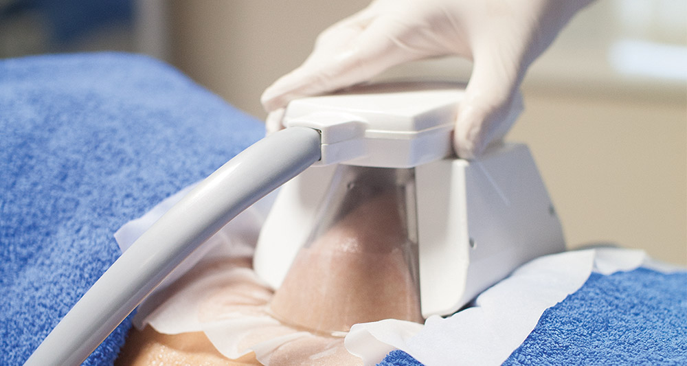 How Fat Freezing and HIFU Work Together? 2 Multiple Areas in One Session HIFU and Fat Freezing Smethwick