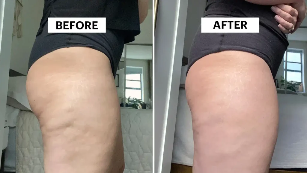 Do Toning Exercise Smethwick Really Tackle Cellulite?