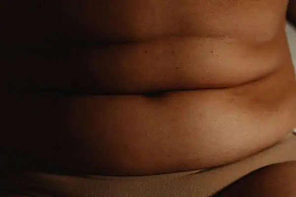 The Hidden Connection: How Stress Shapes Your Fitness and Body Composition 3 image of what stress can do on the stomach area and how Lipo 360 Smethwick can help to change your body shape.